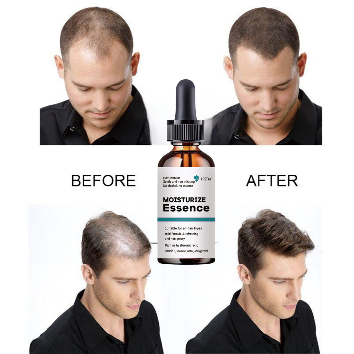 Hair Care Ordinary - Новинка 2022, эссенция для роста волос,