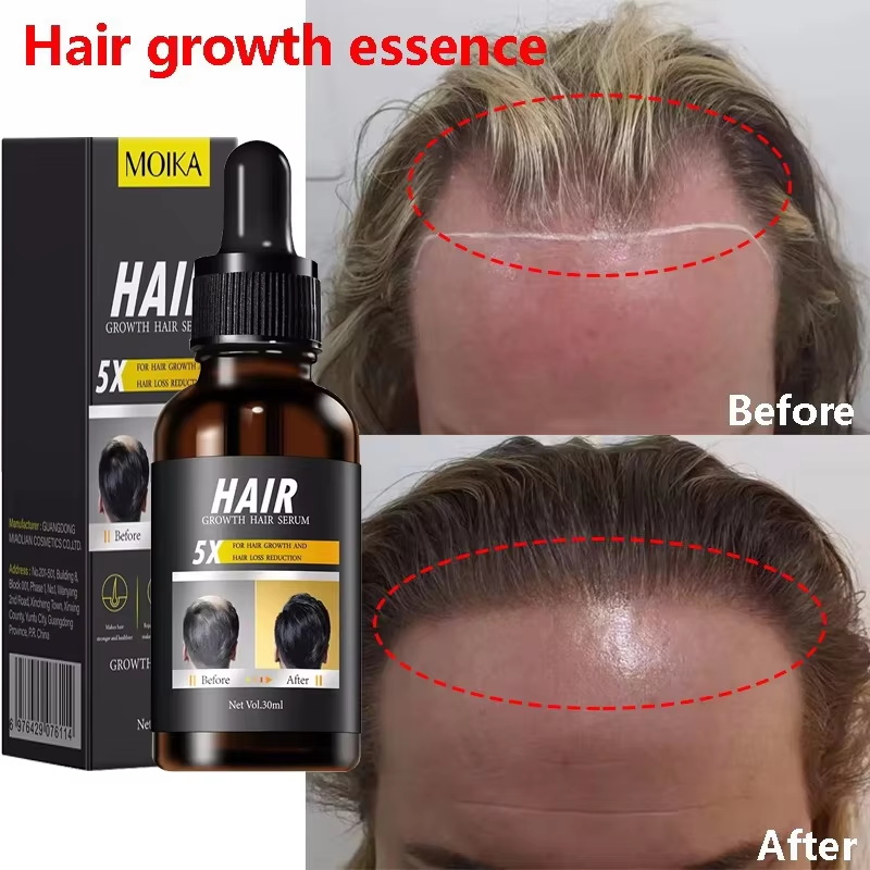 Hair Care Essential Oil Atomizing - Сыворотка для быстрого роста волос, эфирное
