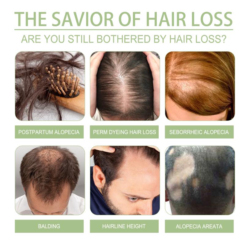 Новое масло для роста волос 10 – обзор и цена Hair Care India