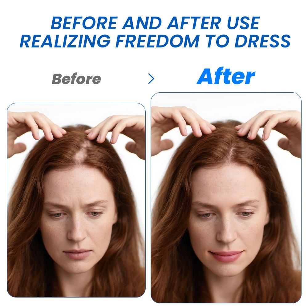 Алопеция Спрей для роста волос – обзор и цена Hair Care Growth