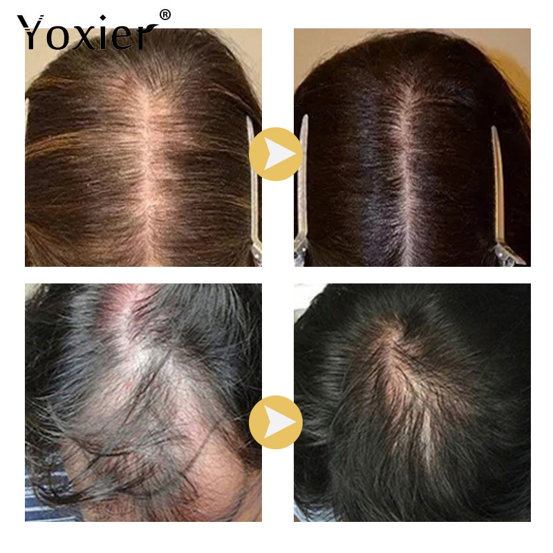 Сыворотка для интенсивного рос – обзор и цена Hair Care Growth