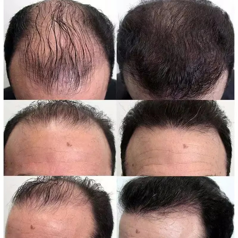 Сыворотка для быстрого роста в – обзор и цена Hair Care Essential Oil Atomizing