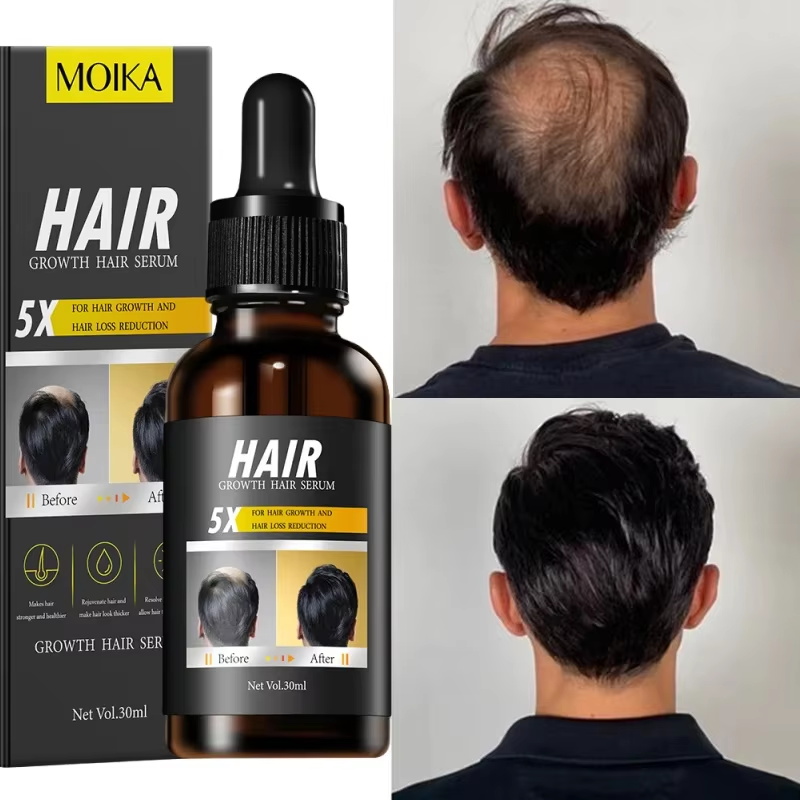 Сыворотка для быстрого роста в – обзор и цена Hair Care Essential Oil Atomizing