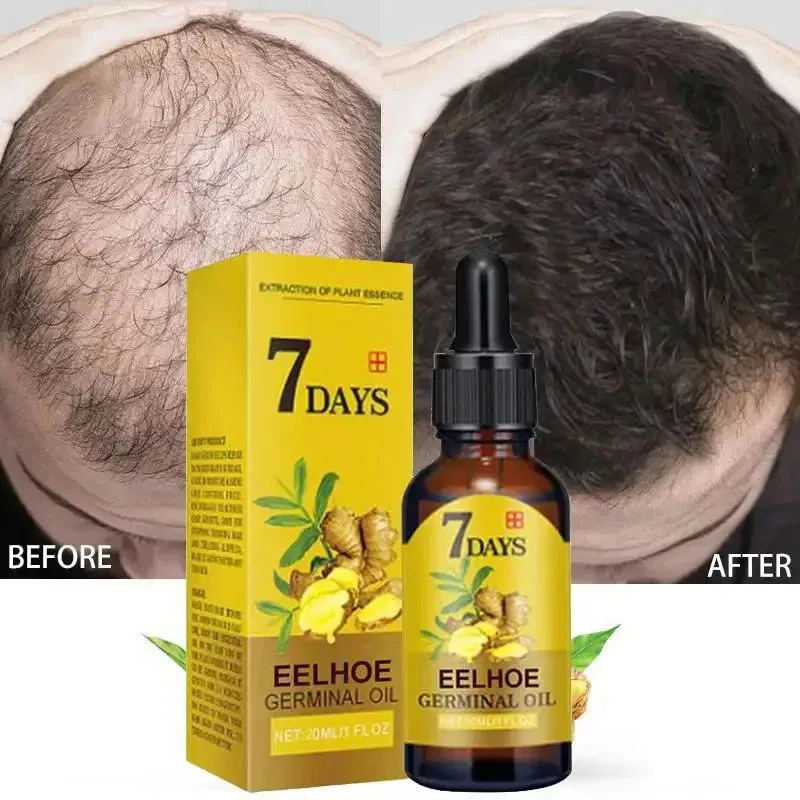 Сыворотка для быстрого роста в – обзор и цена Hair Care Essential Oil Atomizing