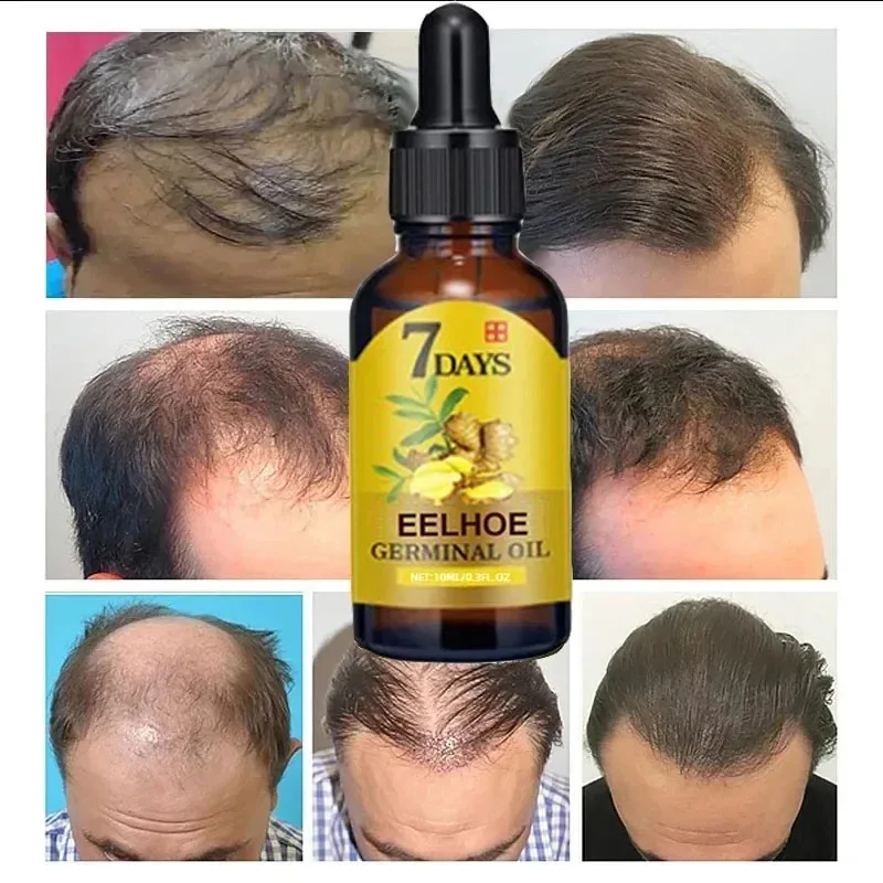 Сыворотка для быстрого роста в – обзор и цена Hair Care Essential Oil Atomizing