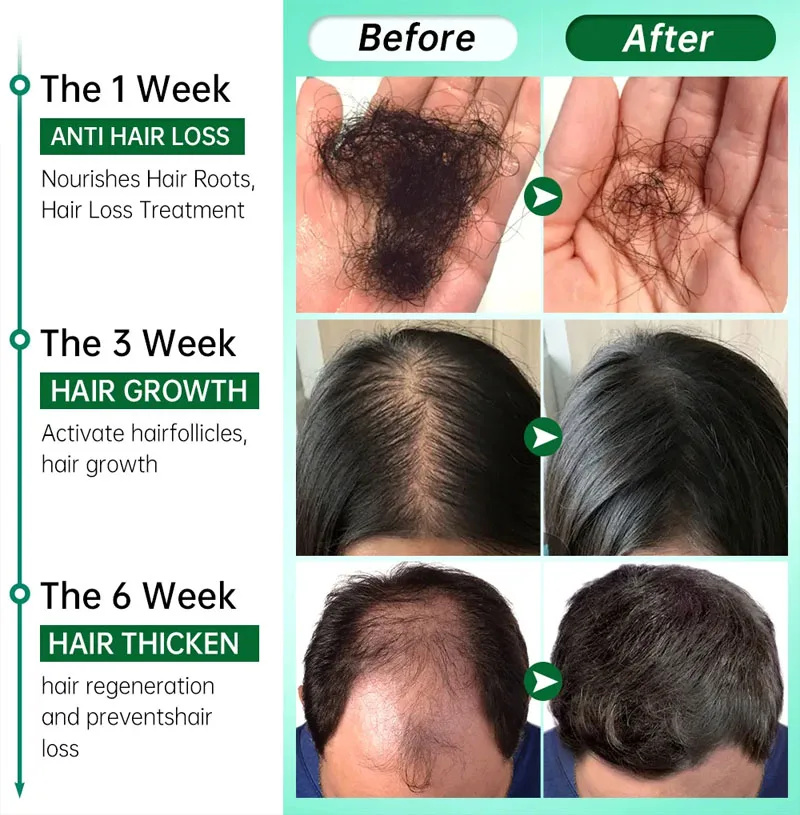 Сыворотка для быстрого роста в – обзор и цена Hair Care Essential Oil Atomizing