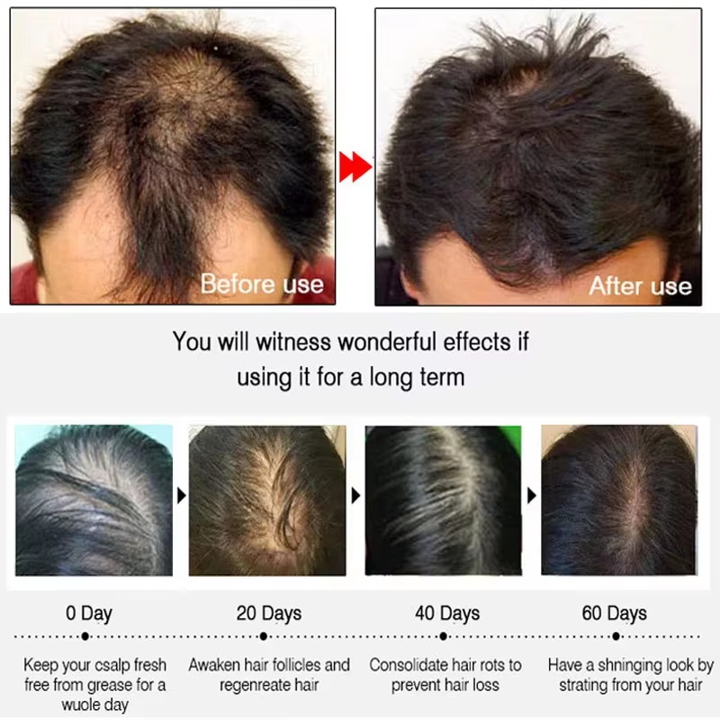 Спрей для быстрого роста волос – обзор и цена Hair Care Growth