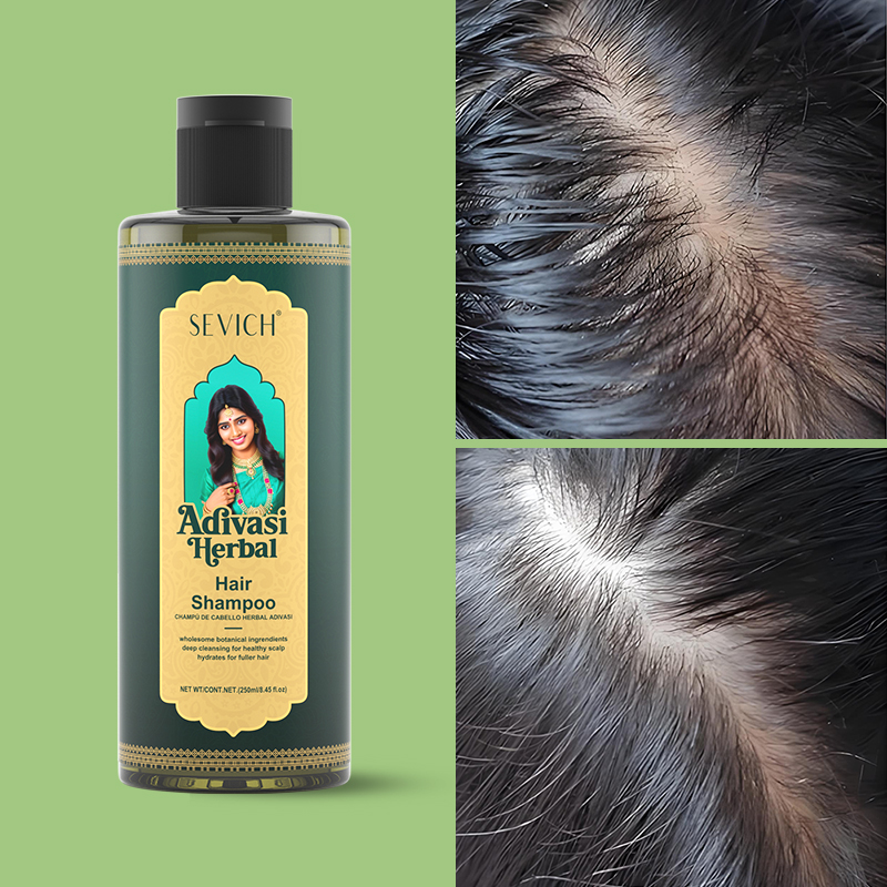 Набор масел для роста волос: Р – обзор и цена Hair Care India